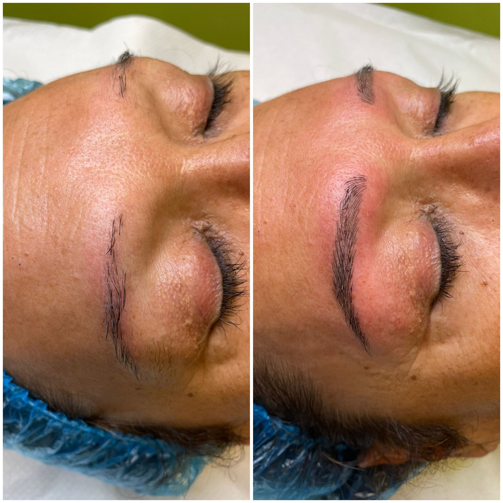 Tratamiento Estética 8
